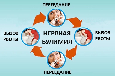 Лечение булимии в Дмитрове